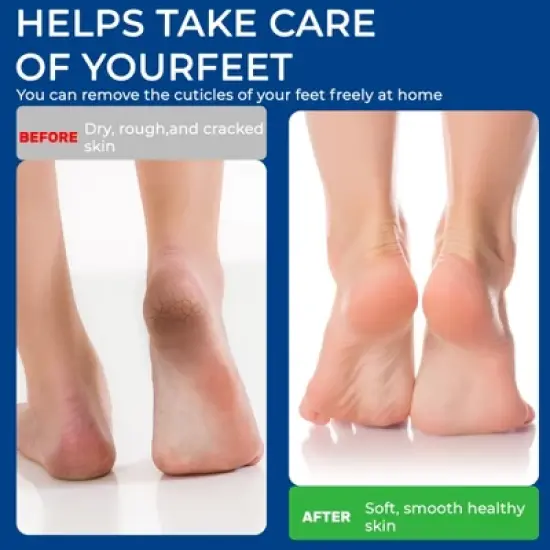 Electric Foot Callus Remover, Rechargeable Professional Pedicure Tools for Feet- White image {5}