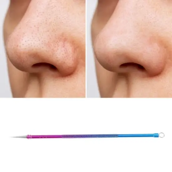 Unique Bargains Facial Gradient Pimple Extractor Blue Purple 1 Pc image {4}