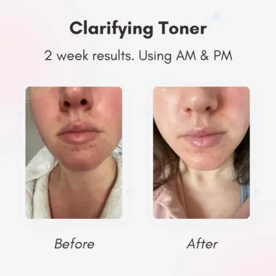 Beautaniq Beauty Clear Skies Skincare Bundle image {7}