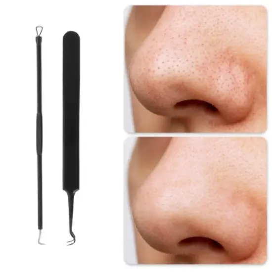 Unique Bargains Regular Pimple Extractor Tool Kit 1 Set image {4}