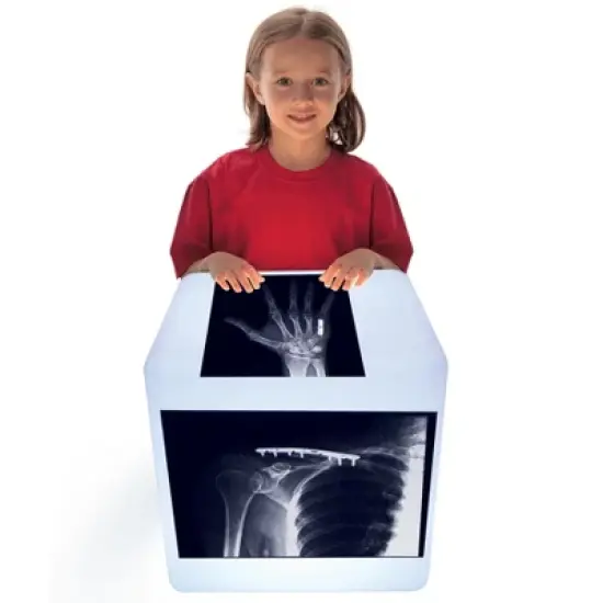 Roylco Fixed Bones X-Ray Set image {1}