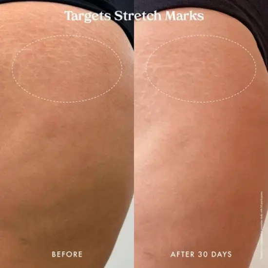 Kopari Ultra Renewal Retinol Body Cream - 4.7 fl oz - Ulta Beauty image {12}