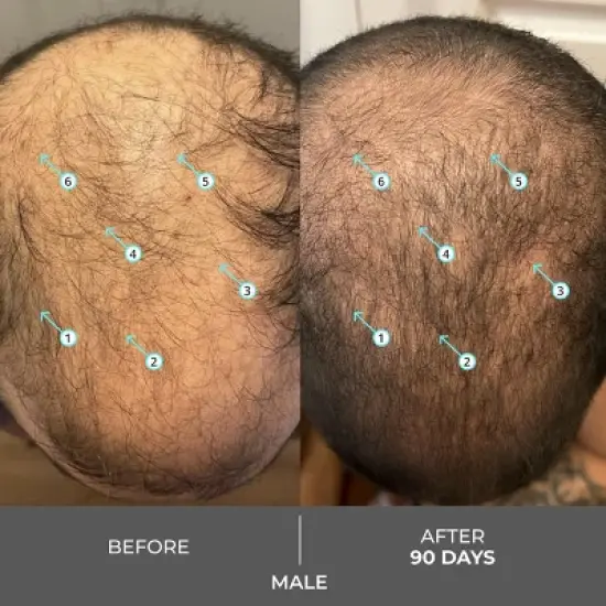 Revita | Extra Strength Hair DENSITY Shampoo image {9}