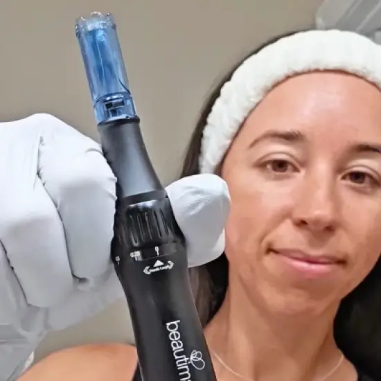 Beautimate Microneedle Pen &ndash; Adjustable At-Home Microneedling Device for Fine Lines, Wrinkles, and Firmer Skin image {9}