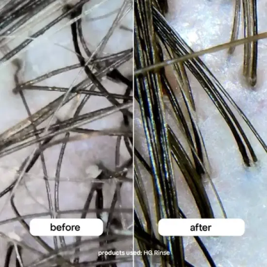 Bondi Boost HG Clarifiying Rinse - 8.45 fl oz - Ulta Beauty image {9}