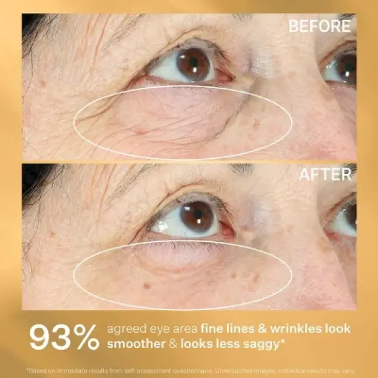 StriVectin Hyperlift Eye Instant Eye Fix - 0.34oz - Ulta Beauty image {6}