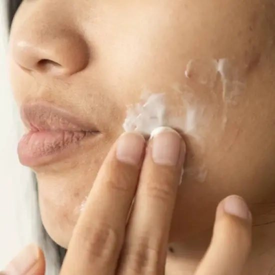 Eczema Honey Soothing Facial Cream - 2oz image {6}