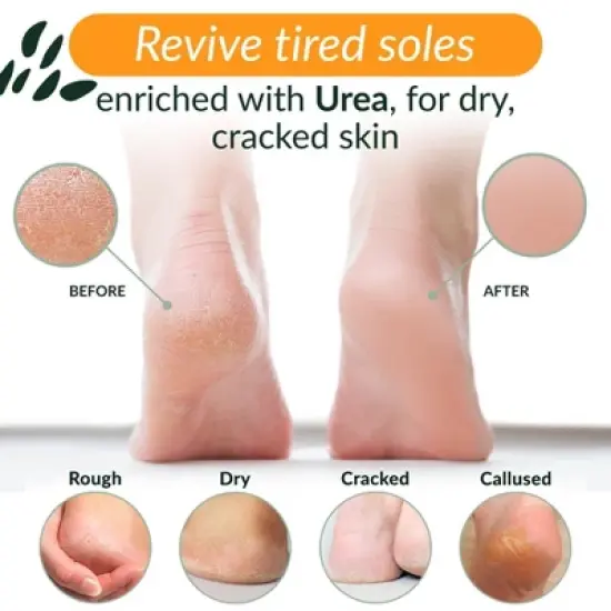 Tree To Tub Foot Cream for Dry Cracked Heels and Feet - Lotion for Dry Cracked Feet Non-Greasy Foot Moisturizer Urea Cream with Shea Cocoa Butter image {1}