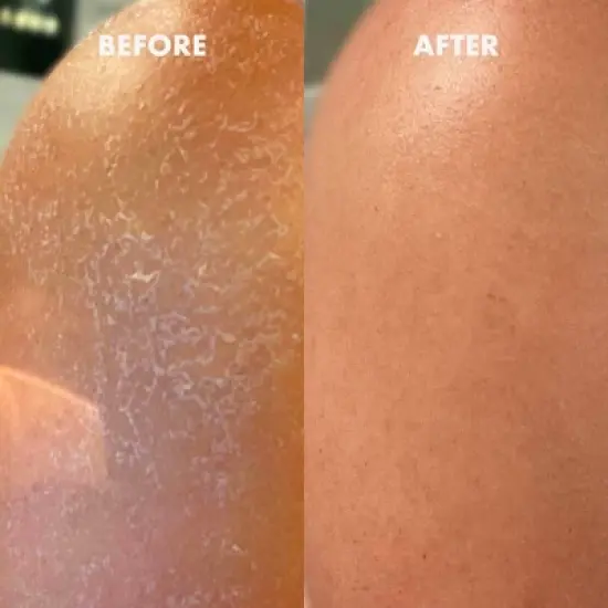 Kopari Ultra Restore Body Butter - 2oz - Ulta Beauty image {2}