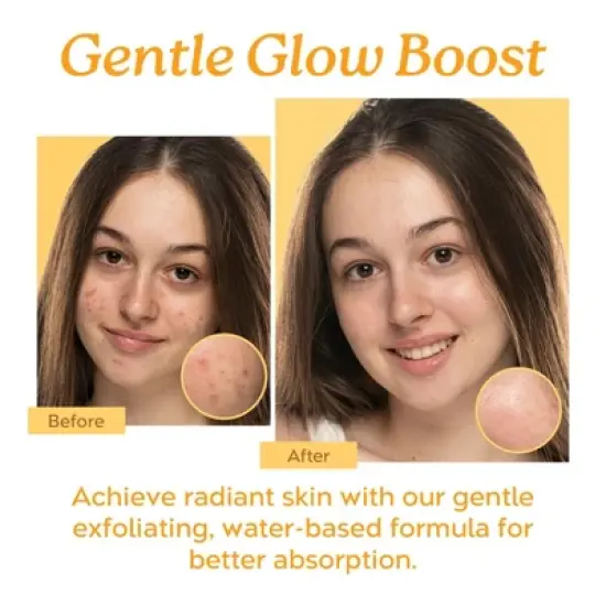 Tree To Tub Mandelic Acid Serum - 10% Gentle Exfoliating AHA Serum - Lactic & Glycolic Acid for Smoother Skin - Vegan Skincare for Men & Women image {1}