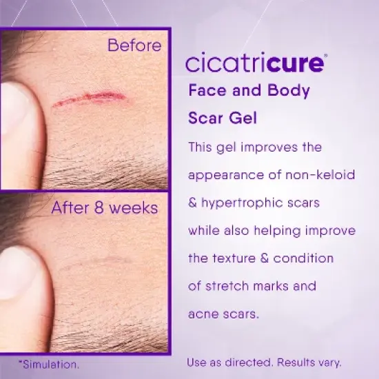 Cicatricure Scar Gel 1oz image {3}
