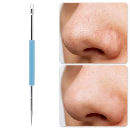 Unique Bargains Professional Durable Pimple Extractor Tool 4.92" Length 1 Pc image {4}