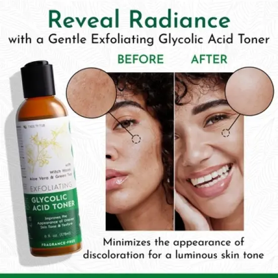 Tree To Tub Glycolic Acid Toner for Face Witch Hazel for Smooth Skin - Minimizes Appearance of Fine Lines - Vegan Exfoliating Toner for Women & Men image {1}