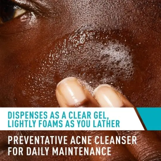 CeraVe Acne Face Cleanser with 2% Salicylic Acid and Purifying Clay for Oily Skin image {6}