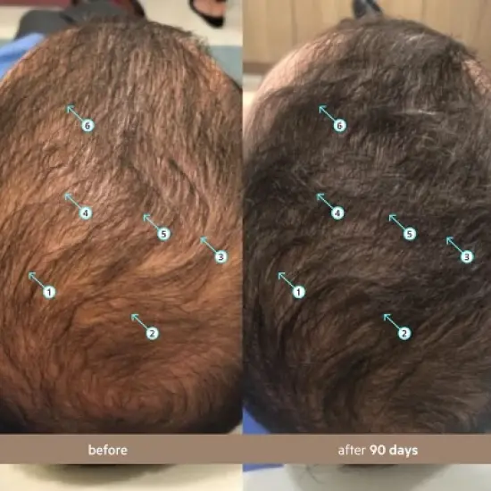 Spectral Men's (DNC-N) | Hair Density Serum with Nanoxidil&reg; 5% image {9}