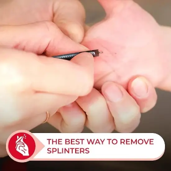 Splinter Out Remover image {5}