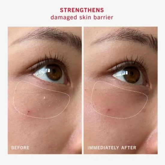 FIRST AID BEAUTY UR Rescue Balm, Moisturizing Face Cream for Dry. Sensitive and Damaged Skin - 2.25oz - Ulta Beauty image {5}