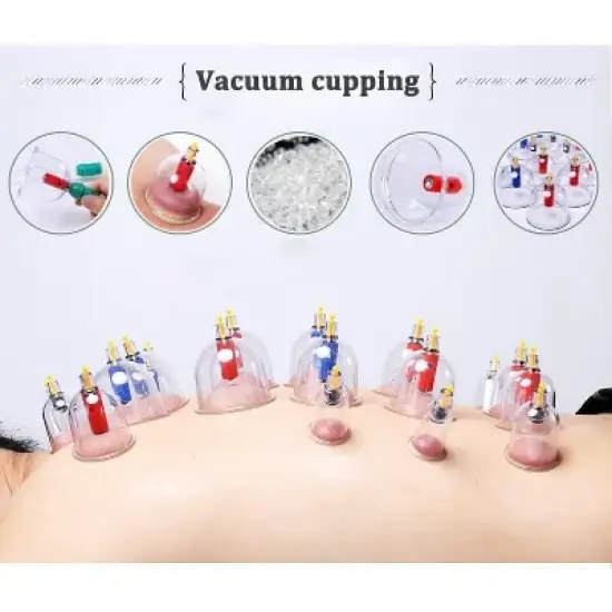 Kangzhu 24-Cup Biomagnetic Chinese Cupping Therapy Set, Multicolored image {7}