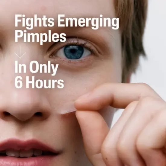 Cetaphil Acne Spot Pimple Patches with Salicylic Acid - 24ct​ image {9}