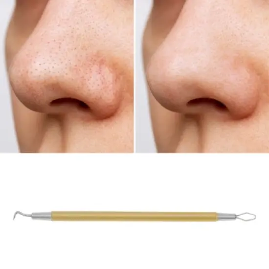 Unique Bargains Durable Double Headed Pimple Extractor 1 Pc image {4}