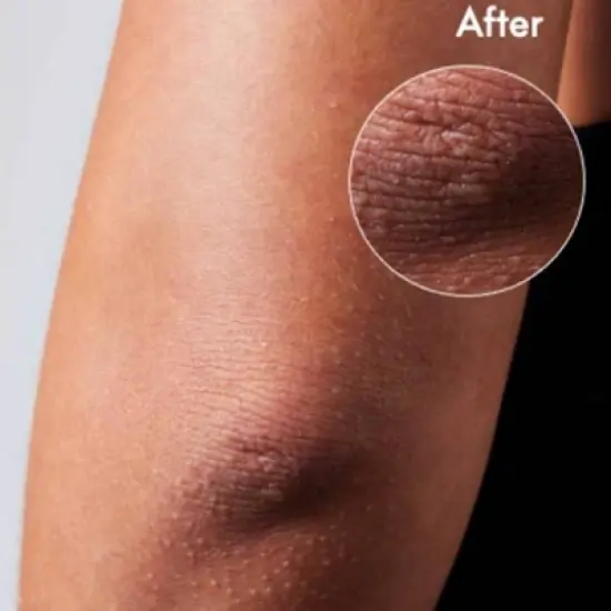 Lanolips 101 Dry Skin Multipurpose Super Cream for Face and Body - 2.02 fl oz image {5}