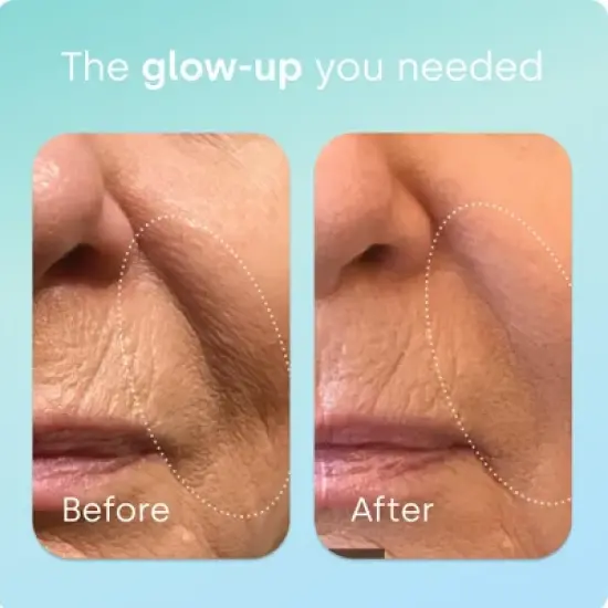 Biosil Healthy Aging - Beauty, Vitality & Thyroid Support - with Patented ch-OSA & Selenium image {2}