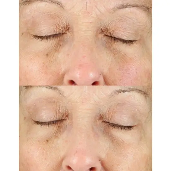 derma e Anti-Aging Regenerative Serum - 2 fl oz image {6}